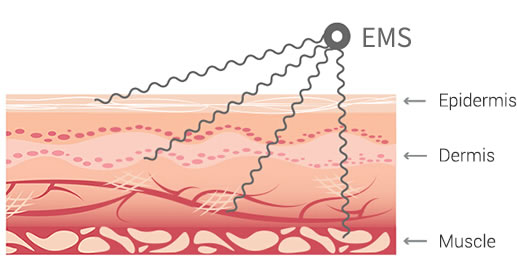 EMS Pain Relieving and Slimming Massage Device