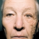 A trucker's face shows the effects of the sun on skin