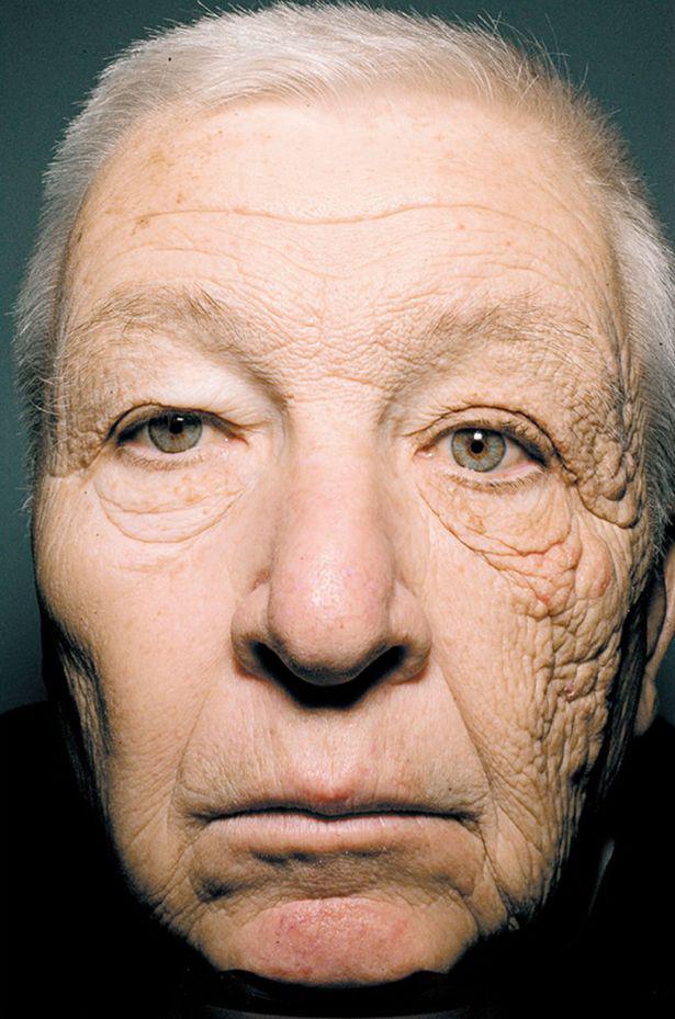 A trucker's face shows the effects of the sun on skin