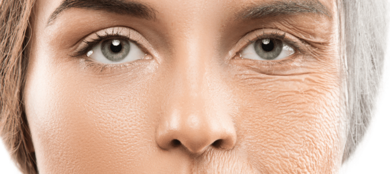 Reducing fine lines