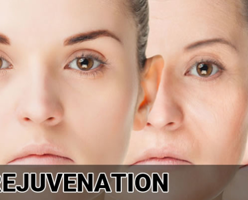 Skin Rejuvenation