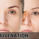 Skin Rejuvenation