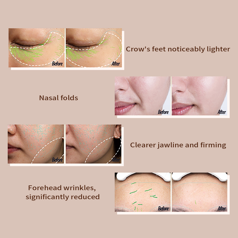 KIRA 24K Gold Beauty Device - L&L Skin